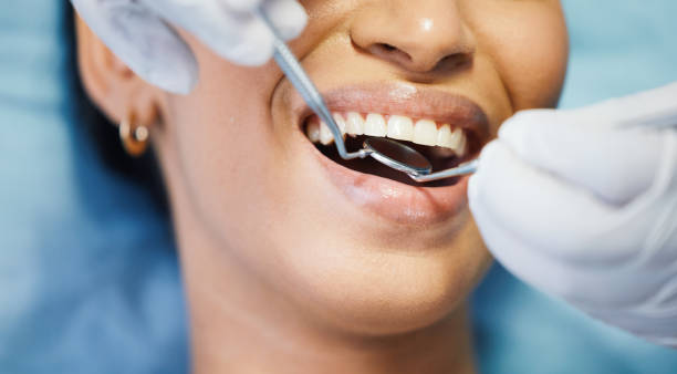 Best Dental Abscess Treatment in Sylacauga, AL